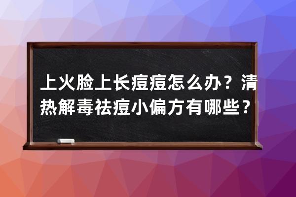 上火脸上长痘痘怎么办？清热解毒祛痘小偏方有哪些？