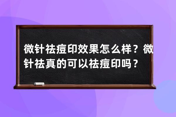 微针祛痘印效果怎么样？微针祛真的可以祛痘印吗？