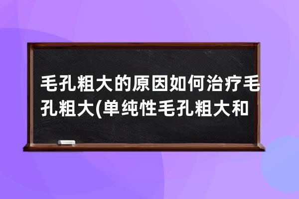 毛孔粗大的原因如何治疗毛孔粗大(单纯性毛孔粗大和器质性毛孔粗大)