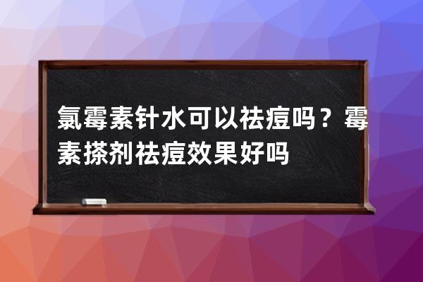 氯霉素针水可以祛痘吗？霉素搽剂祛痘效果好吗?