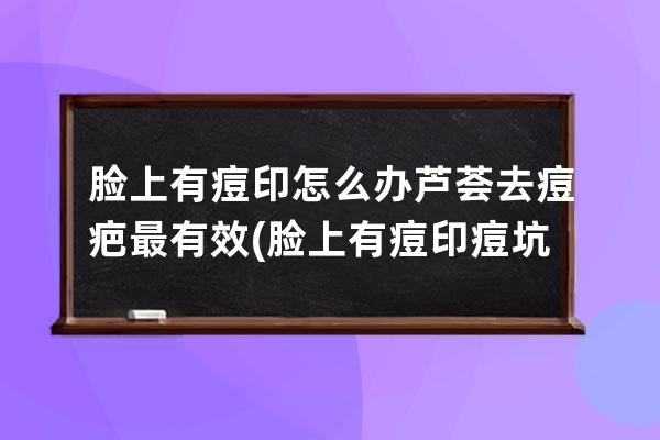 脸上有痘印怎么办芦荟去痘疤最有效(脸上有痘印痘坑痘疤能治好吗)