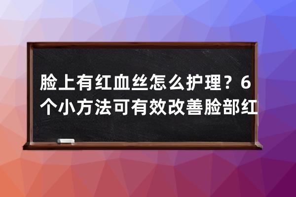 脸上有红血丝怎么护理？6个小方法可有效改善脸部红血丝