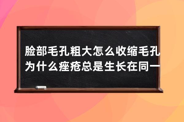 脸部毛孔粗大怎么收缩毛孔? 为什么痤疮总是生长在同一个地方?